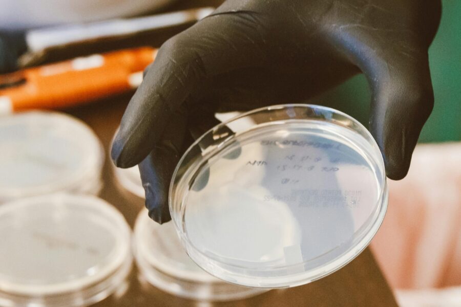 This photo shows a clinical setting and a hand with a glove holding a petry dish